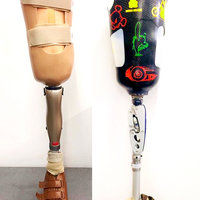 Prothese der Orthomobil GmbH Wien