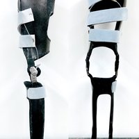 Prothese der Orthomobil GmbH Wien